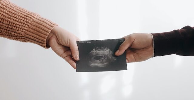 two hands holding a photo of an ultrasound
