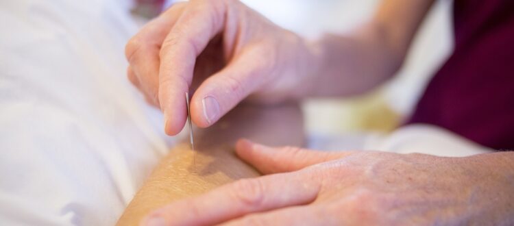 Hand holding an Acupuncture needle that is being inserted into the body