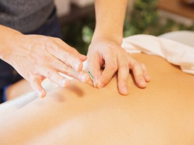 Bare back with hands inserting acupuncture needle