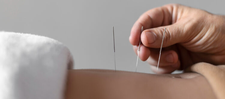 a person receiving acupuncture treatment